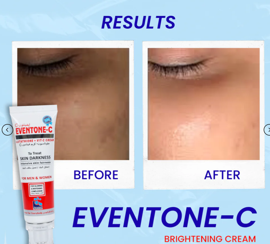 Eventone C Cream ( Skin whitening )
